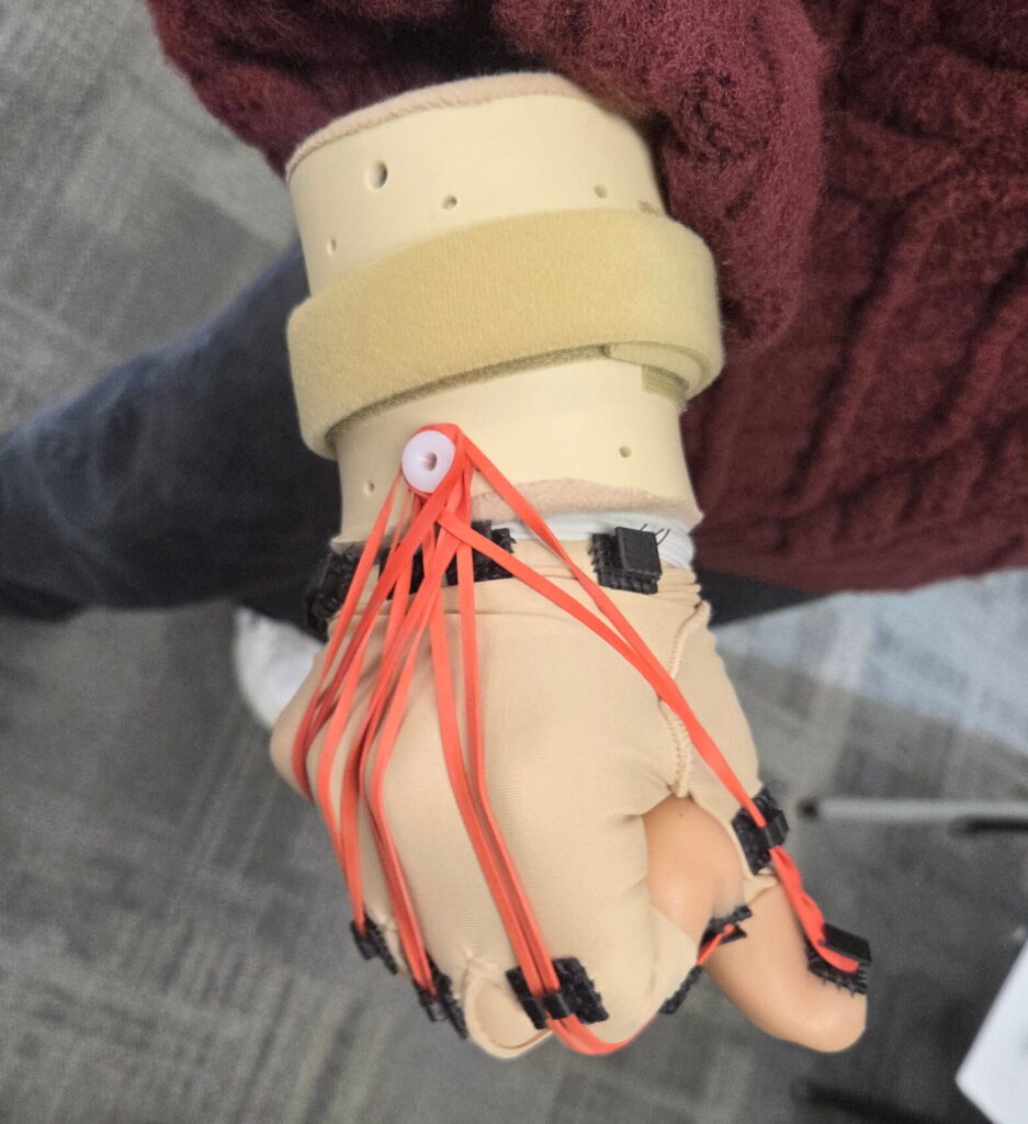 Closed fist hand with resistance glove component. With red rubber bands on each finger.