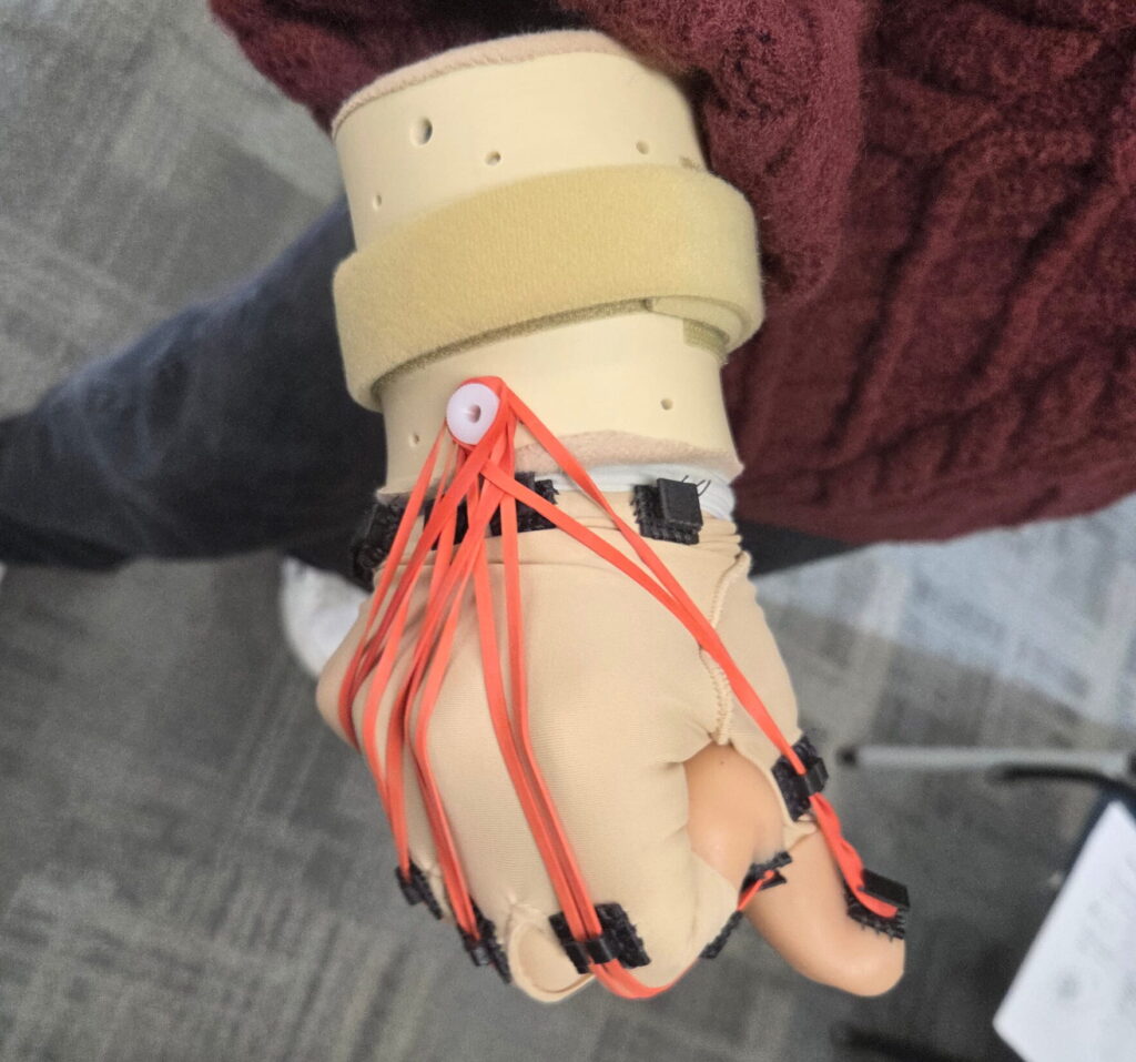Closed fist hand with resistance glove component. With red rubber bands on each finger.
