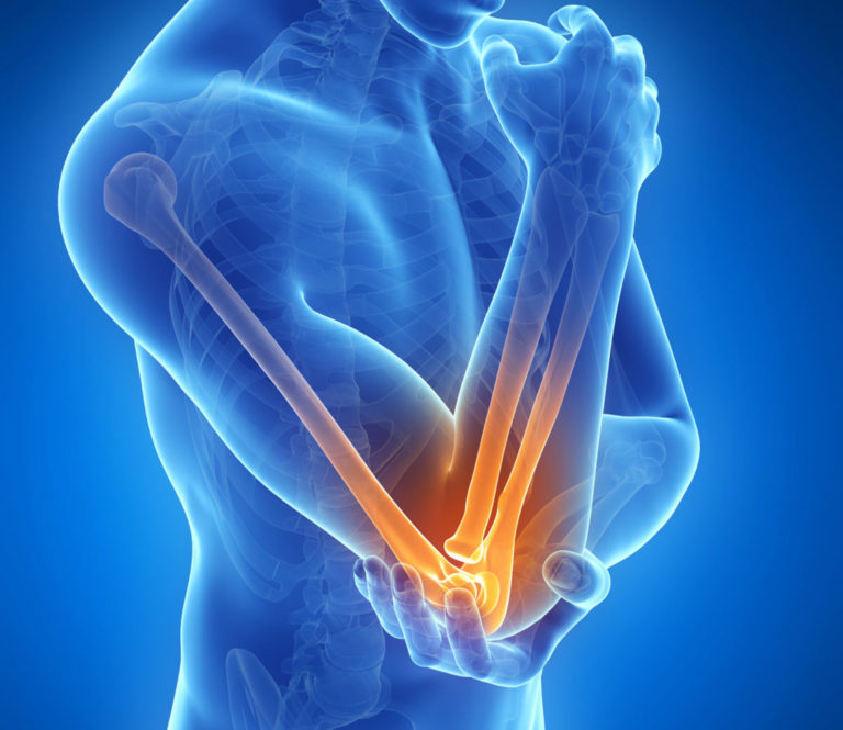 Overview Lateral Epicondylitis Therapy Device