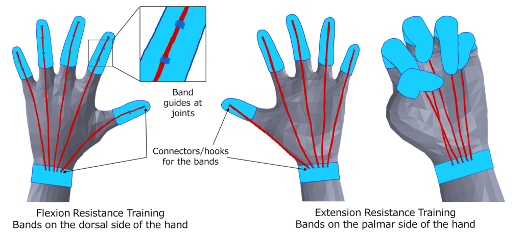 Drawing model of fabric finger cap on each finger and a band around the wrist. Individual red bands connect from the wrist to each finger, totaling 5.